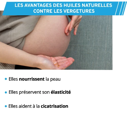 Utiliser des huiles naturelles contre les vergetures